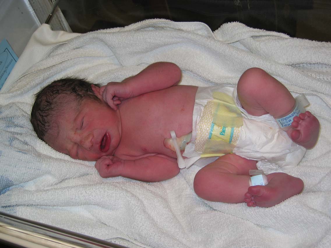 Ребенок первые дни после родов. Новорожденные дети. Новорожденный ребенок только родился.