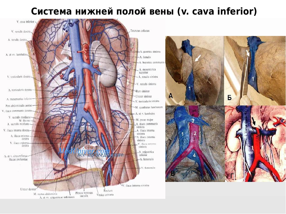 Алтах вена. Нижняя полая Вена (v. Cava inferior). Полая анатомия нижняя Вена анатомия. Нижняя полая Вена Неттер. Нижняя полая Вена анатомия.