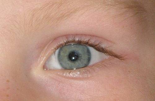 Белки глаз новорожденного. Желтоватые склеры в уголках глаз.