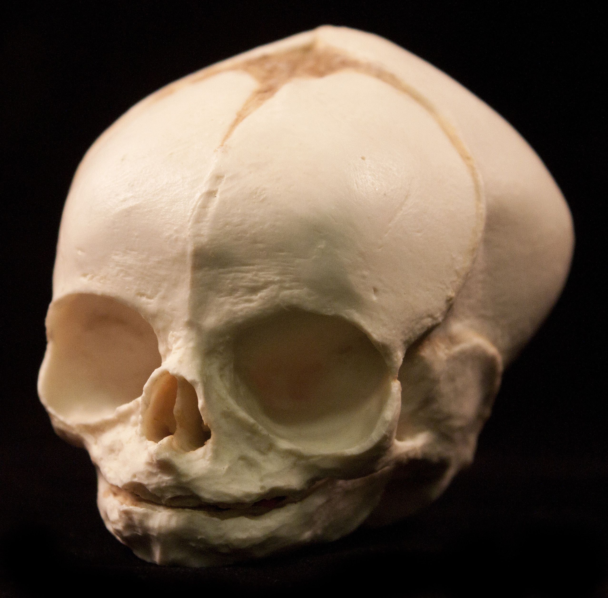 Детский череп анатомия