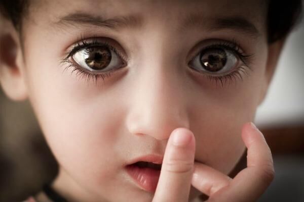 Болезни глаз у детей