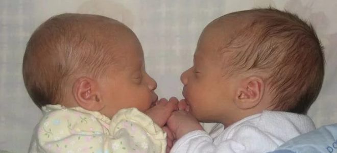 как происходит зачатие близнецов и двойняшек